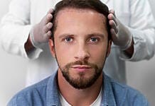 Was sind die Ursachen für Haarausfall und welche Gründe sprechen für eine Haartransplantation?