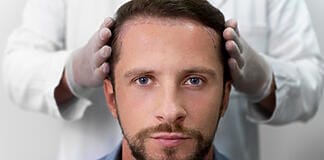 Was sind die Ursachen für Haarausfall und welche Gründe sprechen für eine Haartransplantation?